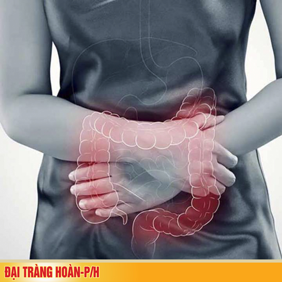 Bệnh lý viêm đại tràng mạn tính: triệu chứng, nguyên nhân và điều trị và phòng bệnh