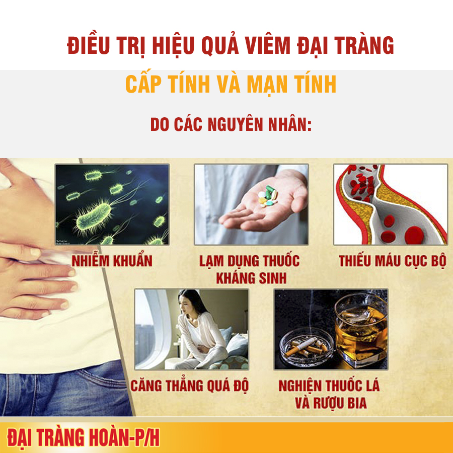 Đại tràng hoàn P/H điều trị hiệu quả viêm đại tràng mạn tính, phòng chống tái phát