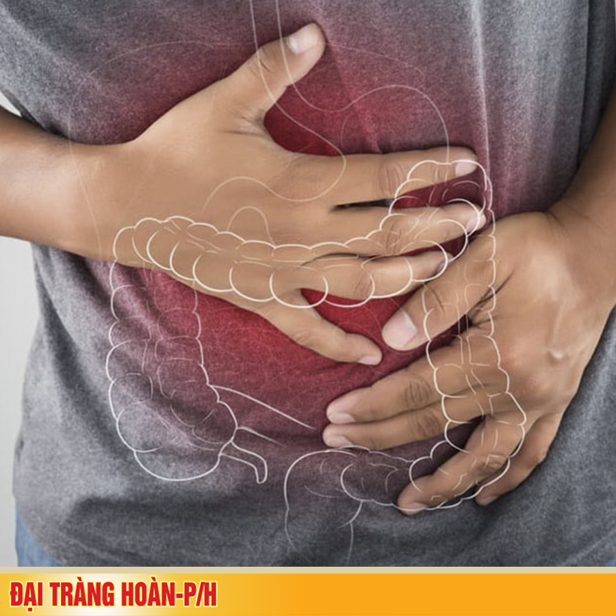 Điều trị dứt điểm viêm đại tràng mạn tính?
